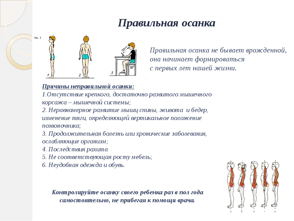 Проект здоровая осанка