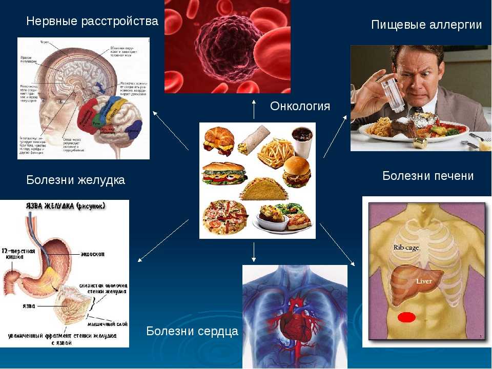 Иммунная карта жкт