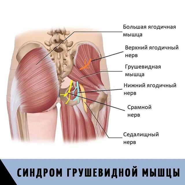 Грушевидная мышца где находится фото