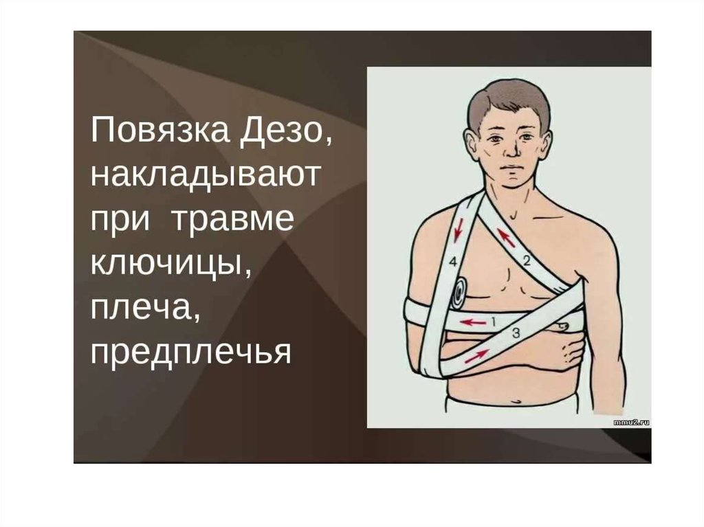 Презентация первая помощь при травмах грудной клетки