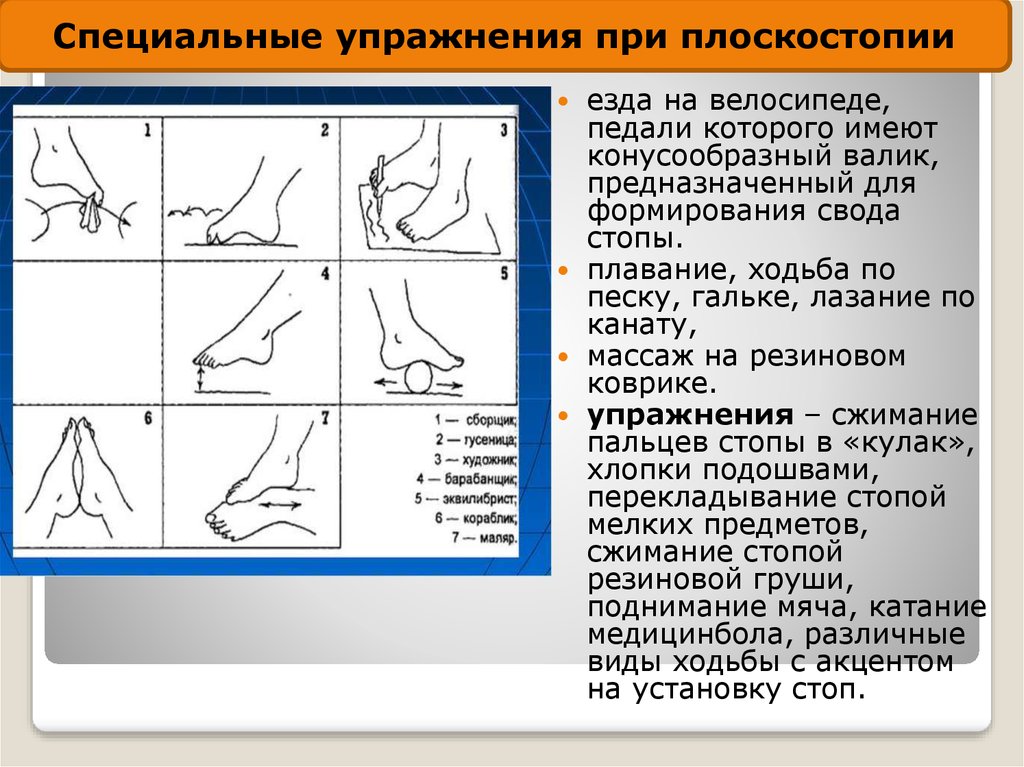 Лечебная гимнастика при плоскостопии с картинками