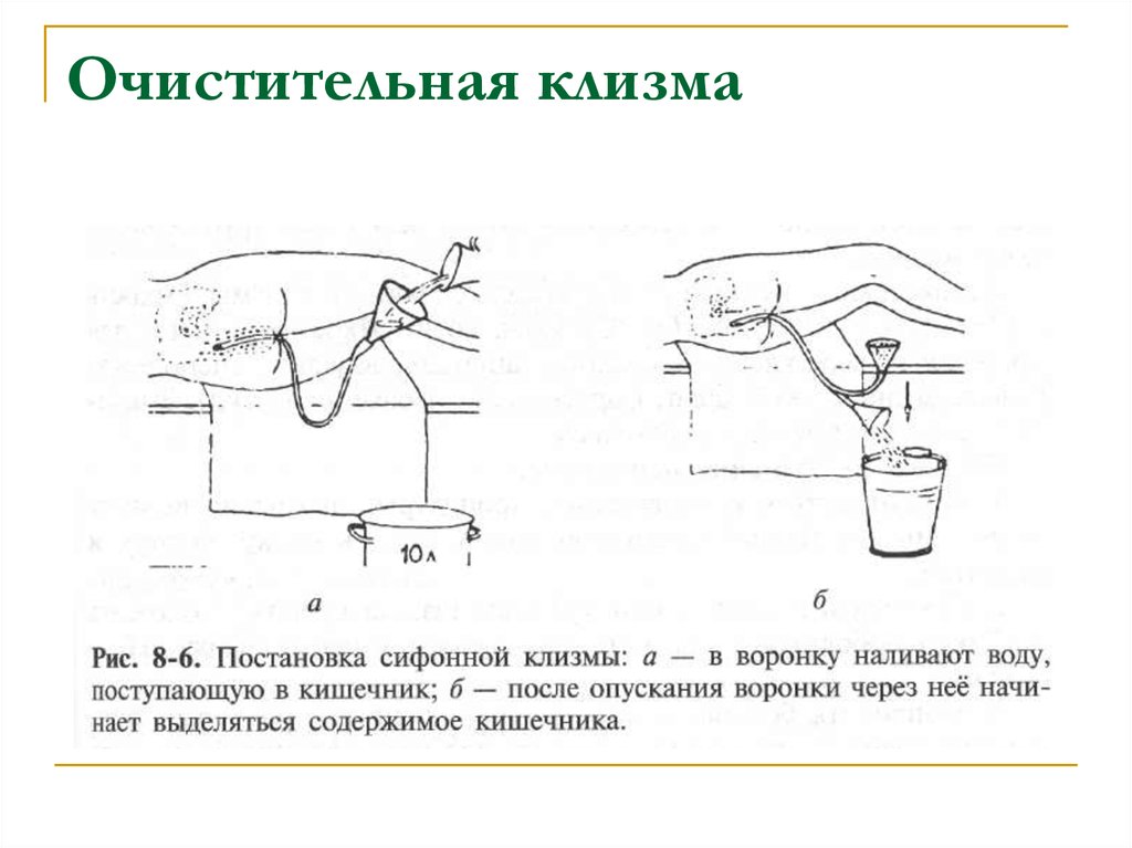 Обработка кишок схема