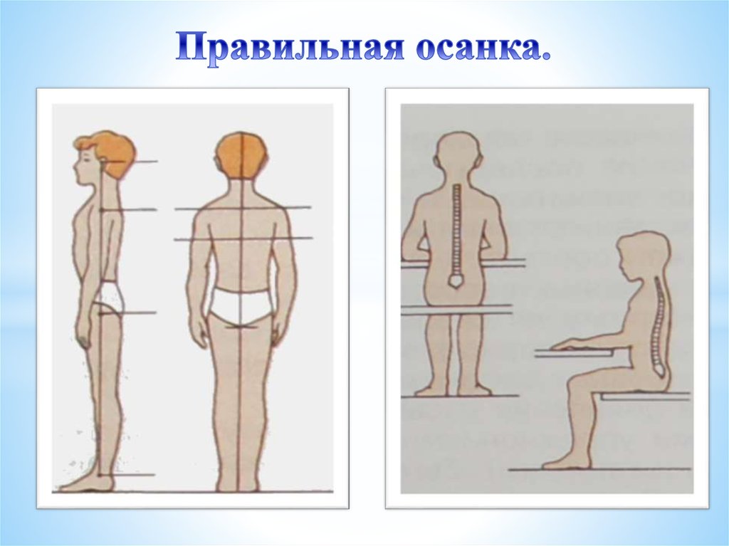 Правильная и неправильная осанка картинки для детей