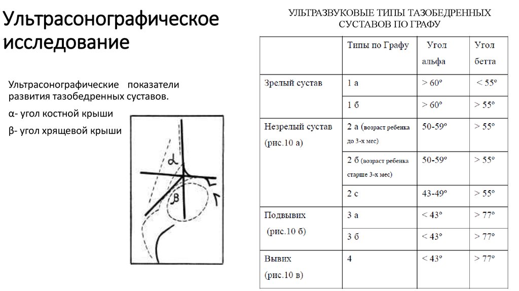 Узи в схемах и таблицах