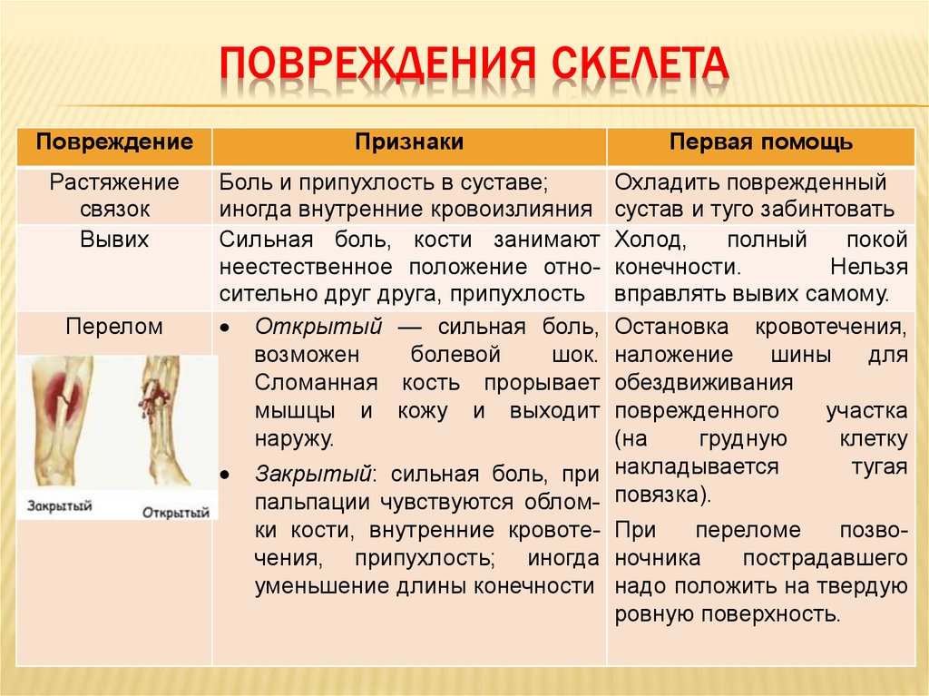 Жар кости не ломит. Первая помощь при повреждении скелета таблица. Первая помощь при травмах скелета 8 класс таблица. Таблица меры первой помощи при повреждениях скелета. Таблица травмы человек.