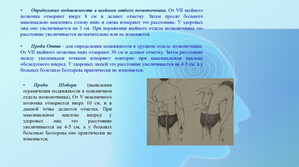 Группа при болезни бехтерева