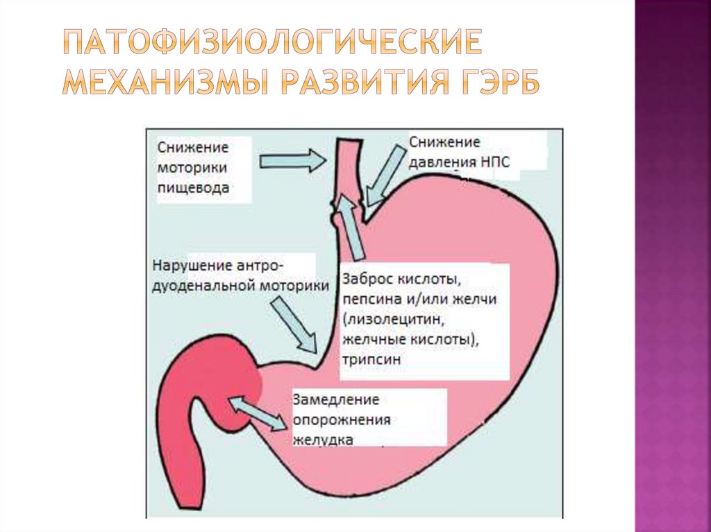 Заброс кислоты из желудка в пищевод. Ахалазия патофизиология. Выброс желчи в пищевод. Заброс желчи в желудок и пищевод.
