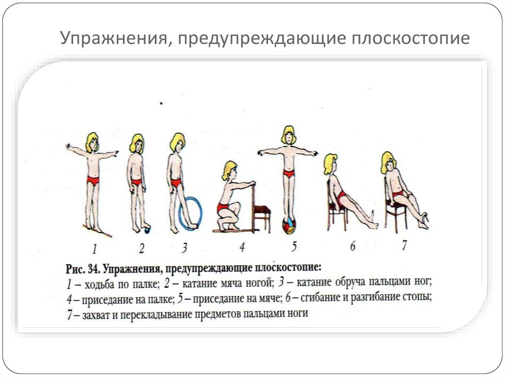 План конспект лфк при плоскостопии