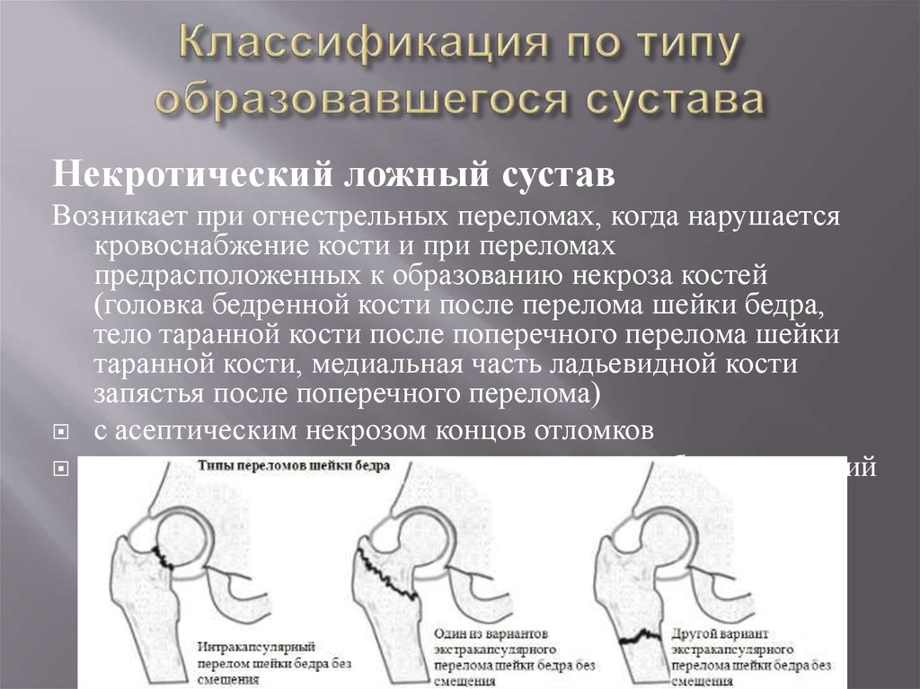 Перелом шейки бедра карта вызова скорой помощи шпаргалка