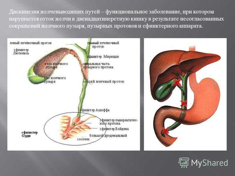 Схема лечения основных форм джвп по а в мазурину