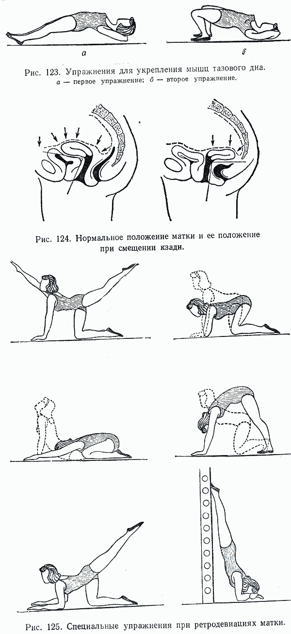 Гимнастика при опущении матки в пожилом возрасте в картинках