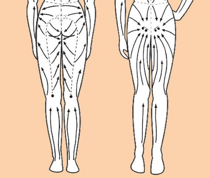 Лимфодренажный массаж линии картинки