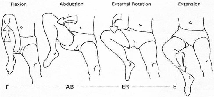 Тест на тазобедренный сустав. Тест Патрика на тазобедренный сустав. Антеторсия тазобедренных суставов у детей. Тест Faber тазобедренный сустав. Управление лягушка для тазобедренного сустава.