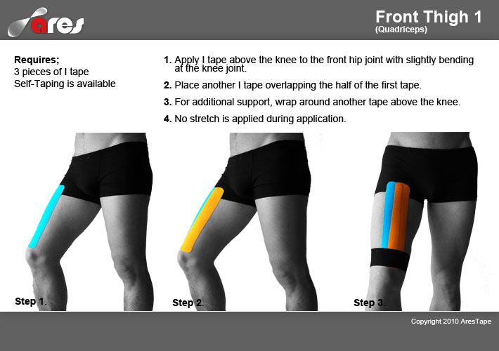 Тейпирование задней поверхности бедра при растяжении схемы