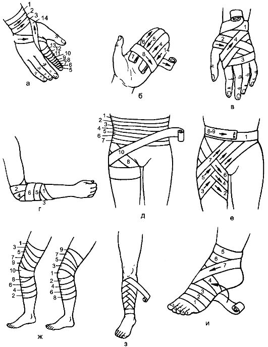 Схемы бинтования рук