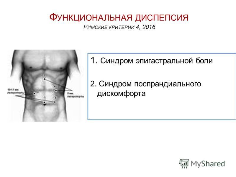 Где находится эпигастральная область у мужчин фото