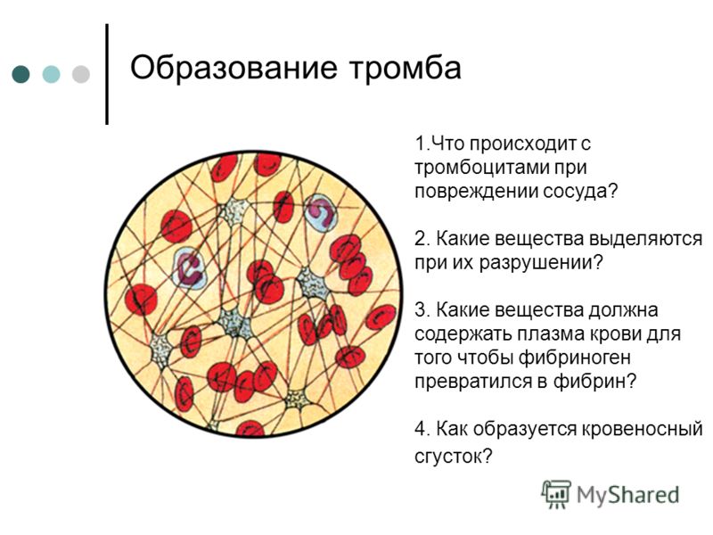 Схема образования фибринового тромба