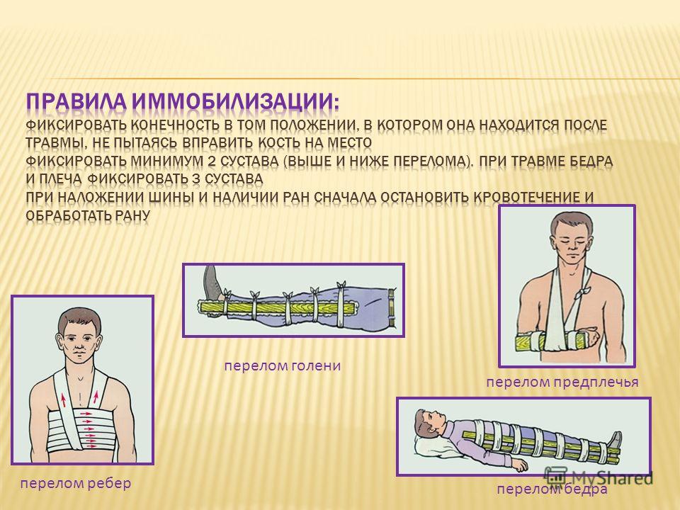 Закрытый перелом предплечья первая помощь