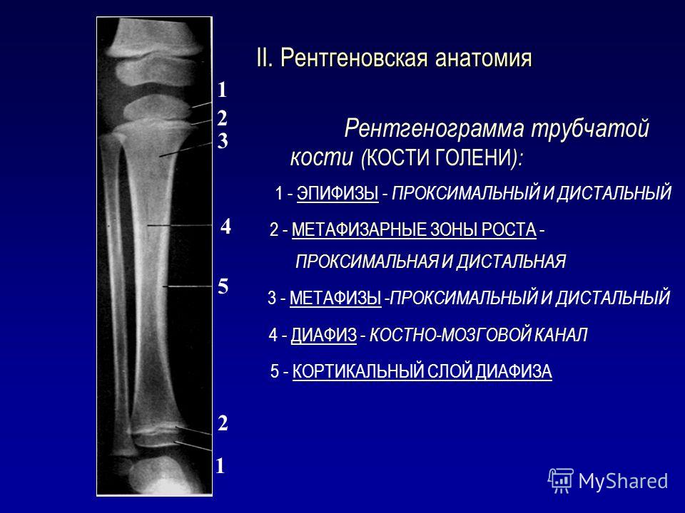 Характеристика изображений на рентгенограммах