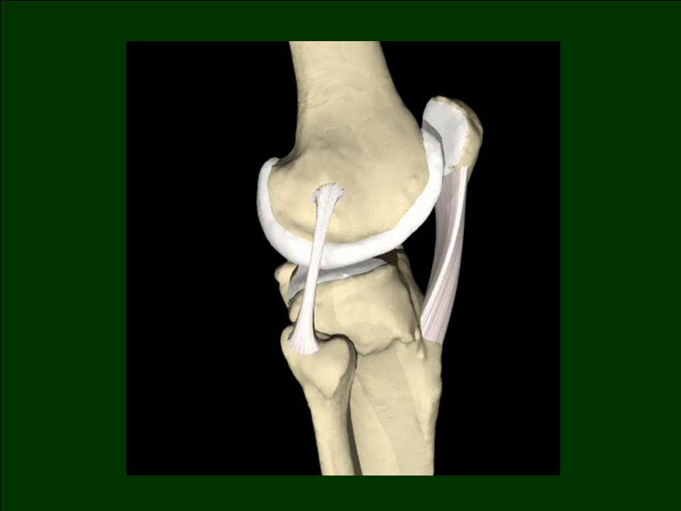 Передняя крестообразная связка коленного сустава. Разрыв крестообразной связки коленного сустава.
