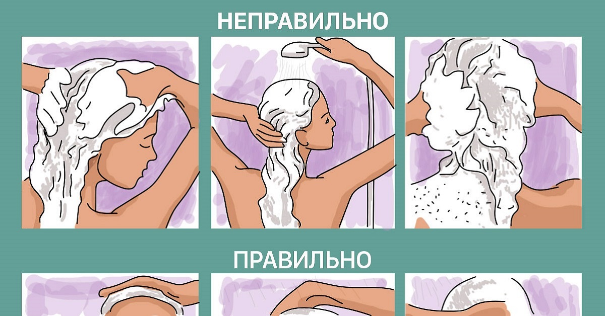 Могут ли выпадать волосы из за частого мытья головы