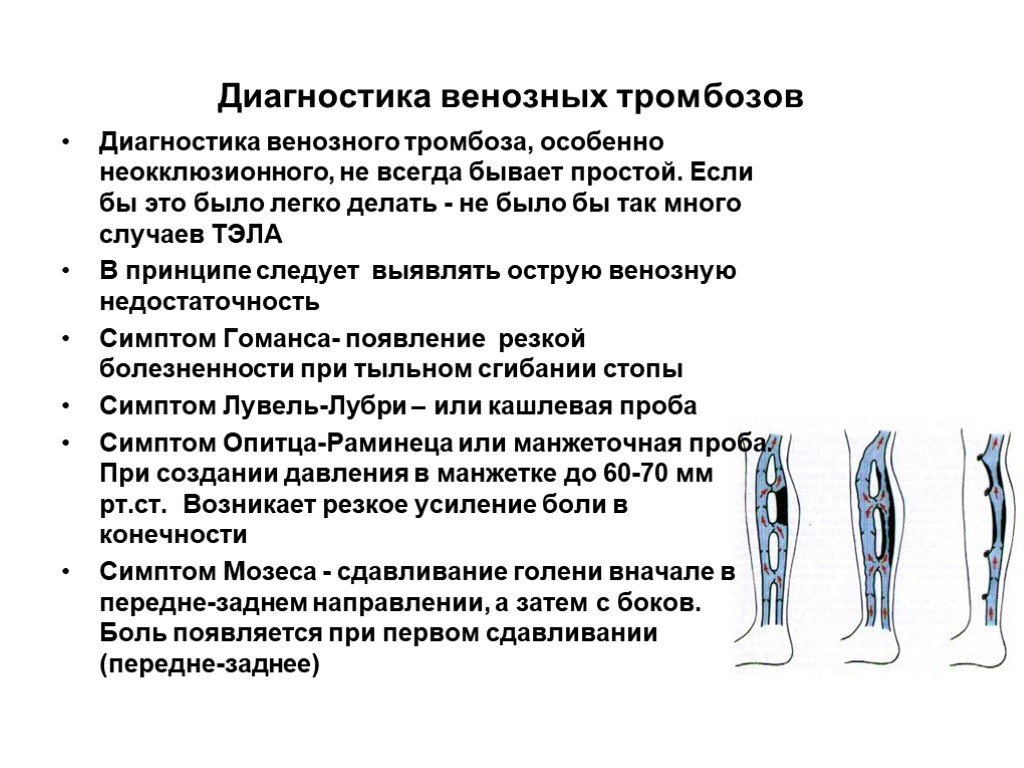 Тромбофлебит нижних конечностей лечение препараты схема лечения симптомы