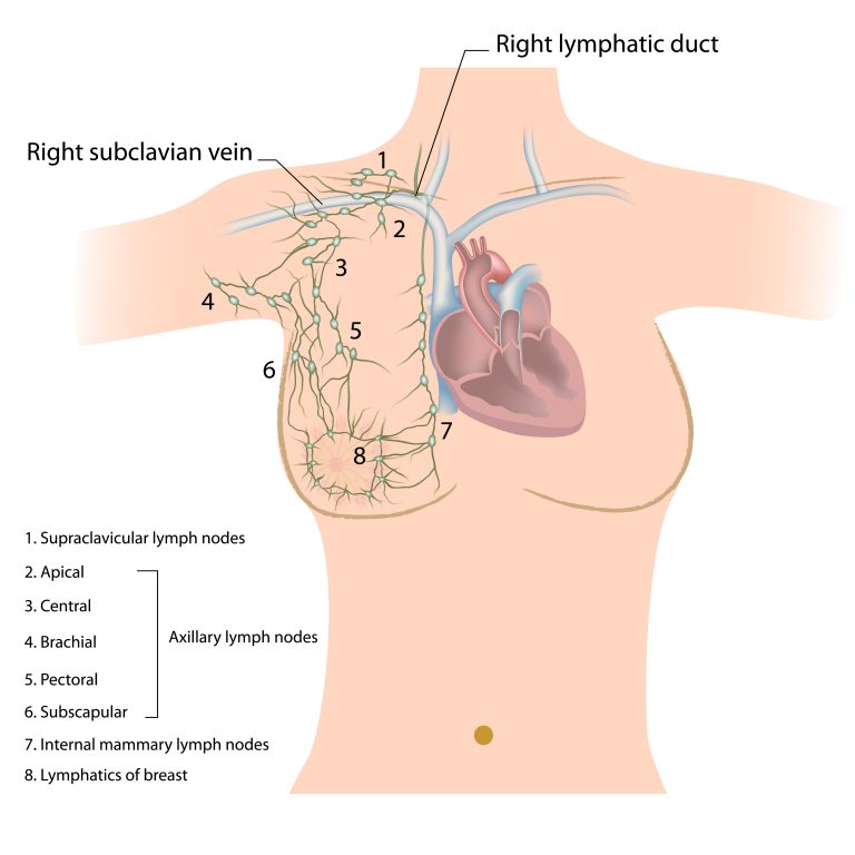 Лимфоузлы под мышками расположение схема у женщин причины возникновения и лечение у женщин