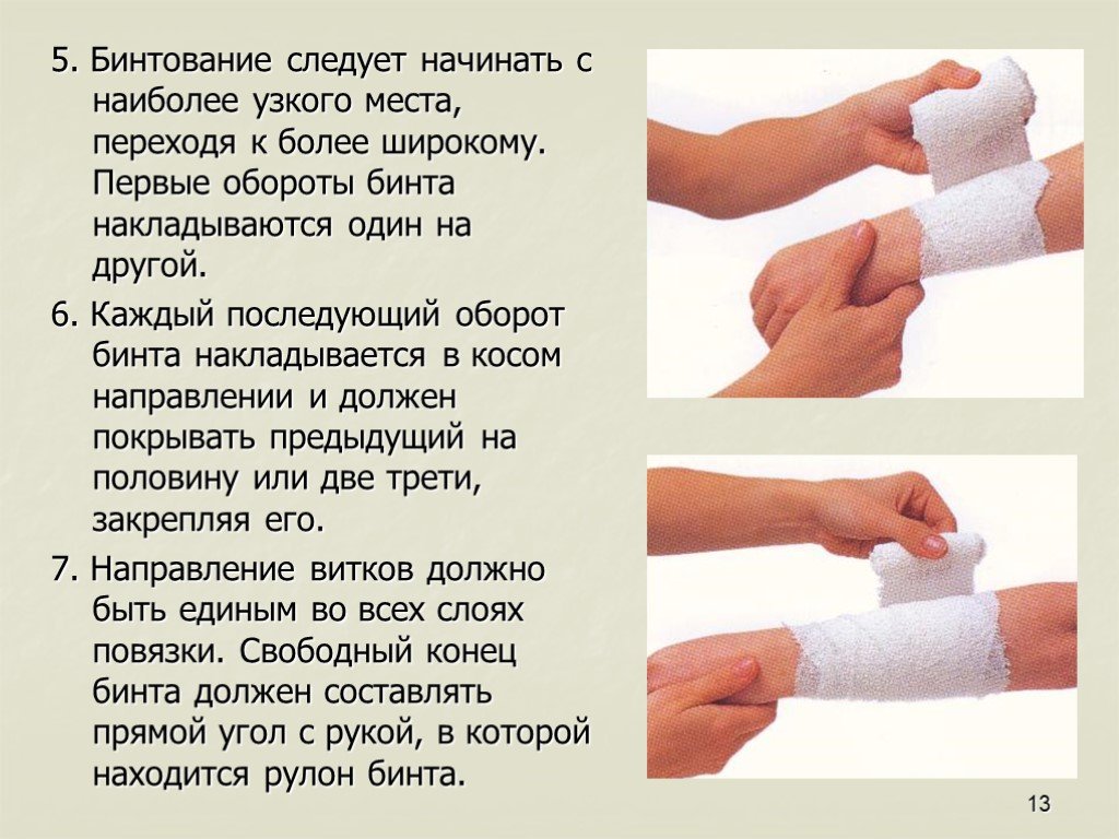 Способы наложения повязок при кровотечении. Правильное наложение повязок. Бинтовые повязки. Правил накладывания бинтовых повязок.