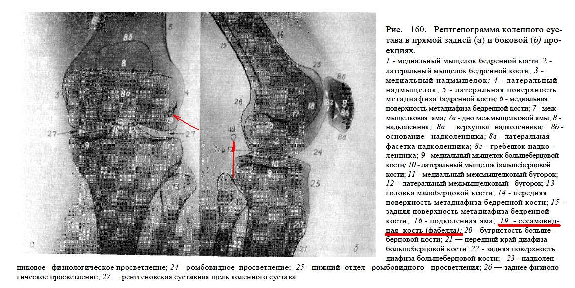 Медиальная мыщелка бедра. Суставная мышь коленного сустава описание. Коленный сустав рентген анатомия. Строение коленного сустава рентген. Коленный сустав рентгенанатомич.