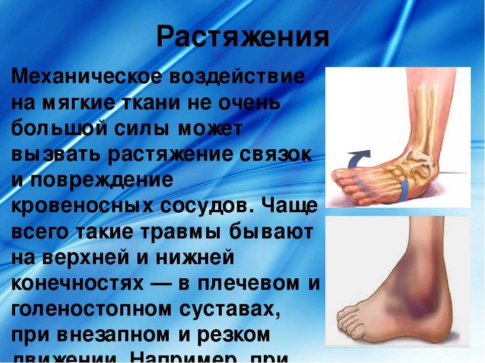 Ушибы растяжения презентация
