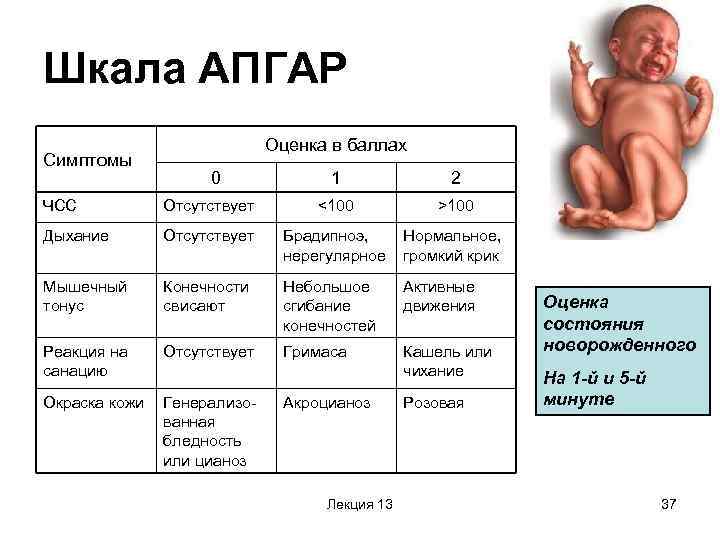 Асфиксия новорожденных шкала Апгар. Беременность шкала Апгар. Гипоксия плода шкала Апгар.
