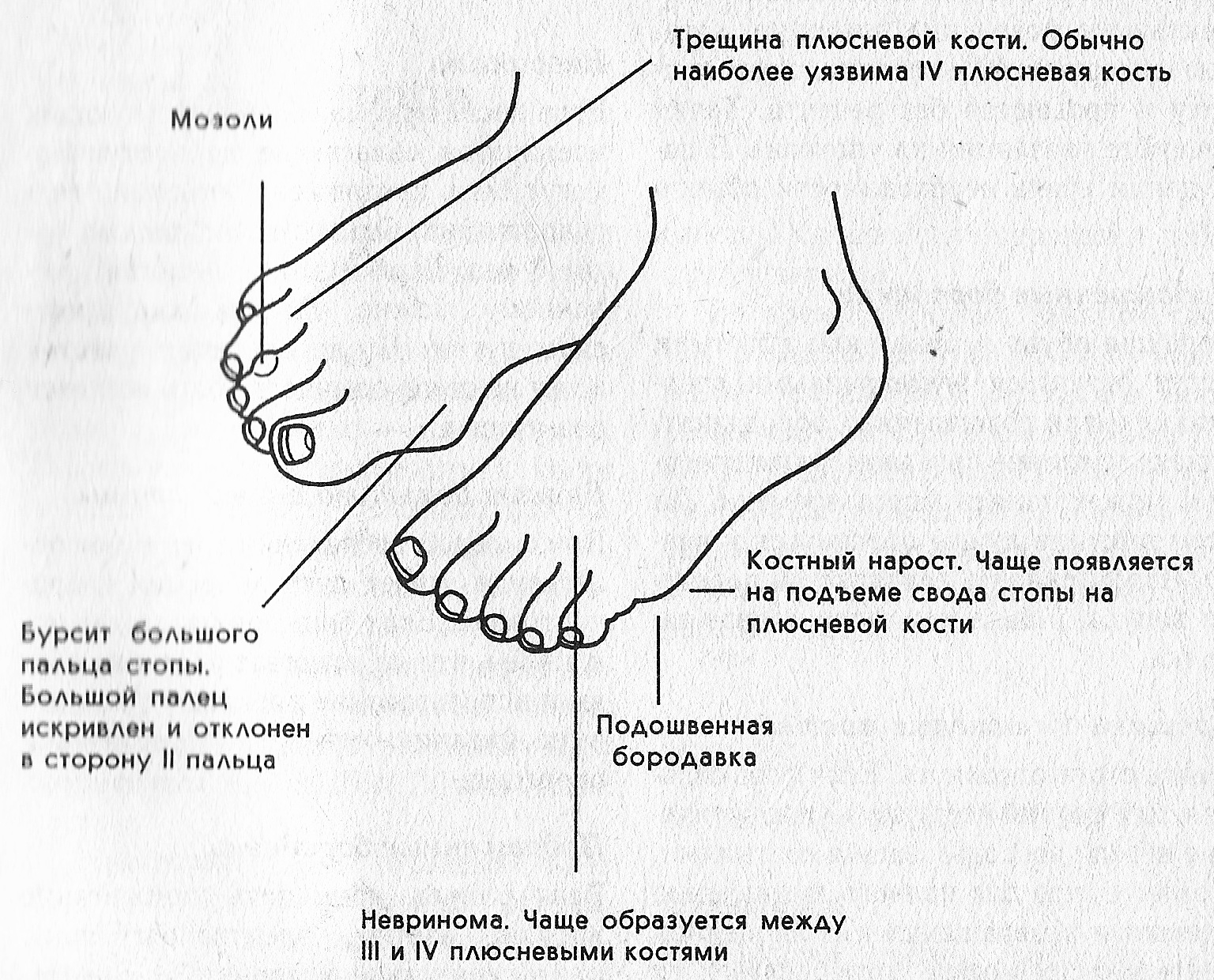 Почему болит правая нога. Части стопы. Болит стопа пальцев на ноге. Тыльная часть стопы болит. Боль в стопе под пальцами в подушечке.