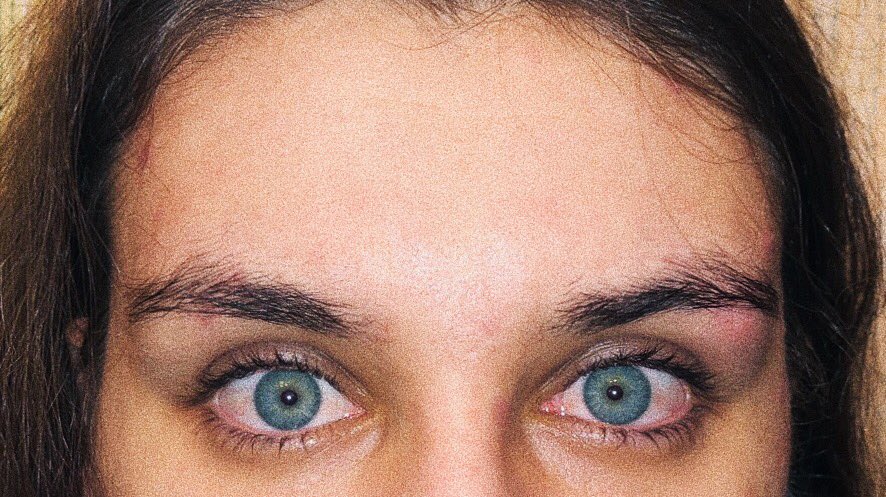 красные глаза от каких наркотиков