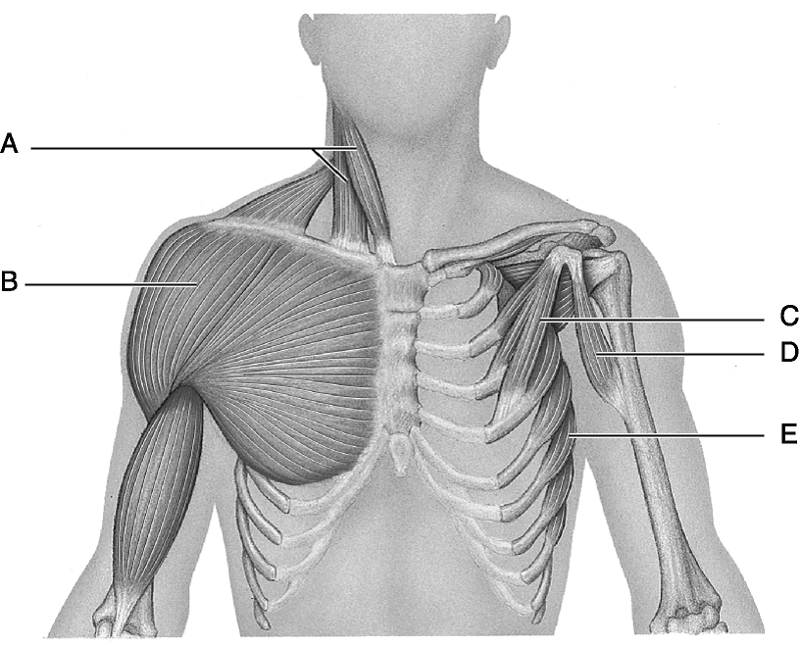 Удаление грудной мышцы. Малая грудная мышца анатомия. Малая грудная грудной мышцы анатомия. Анатомия мышц грудной клетки человека. Грудные мышцы анатомия.